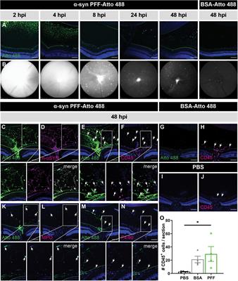 Absence of Uptake and Prion-Like Spreading of Alpha-Synuclein and Tau After Intravitreal Injection of Preformed Fibrils